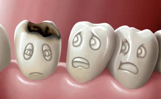 как защитить зубы от кариеса